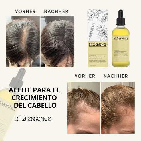Bǐlā Essence Crecimiento del cabello 100% natural 🌱
